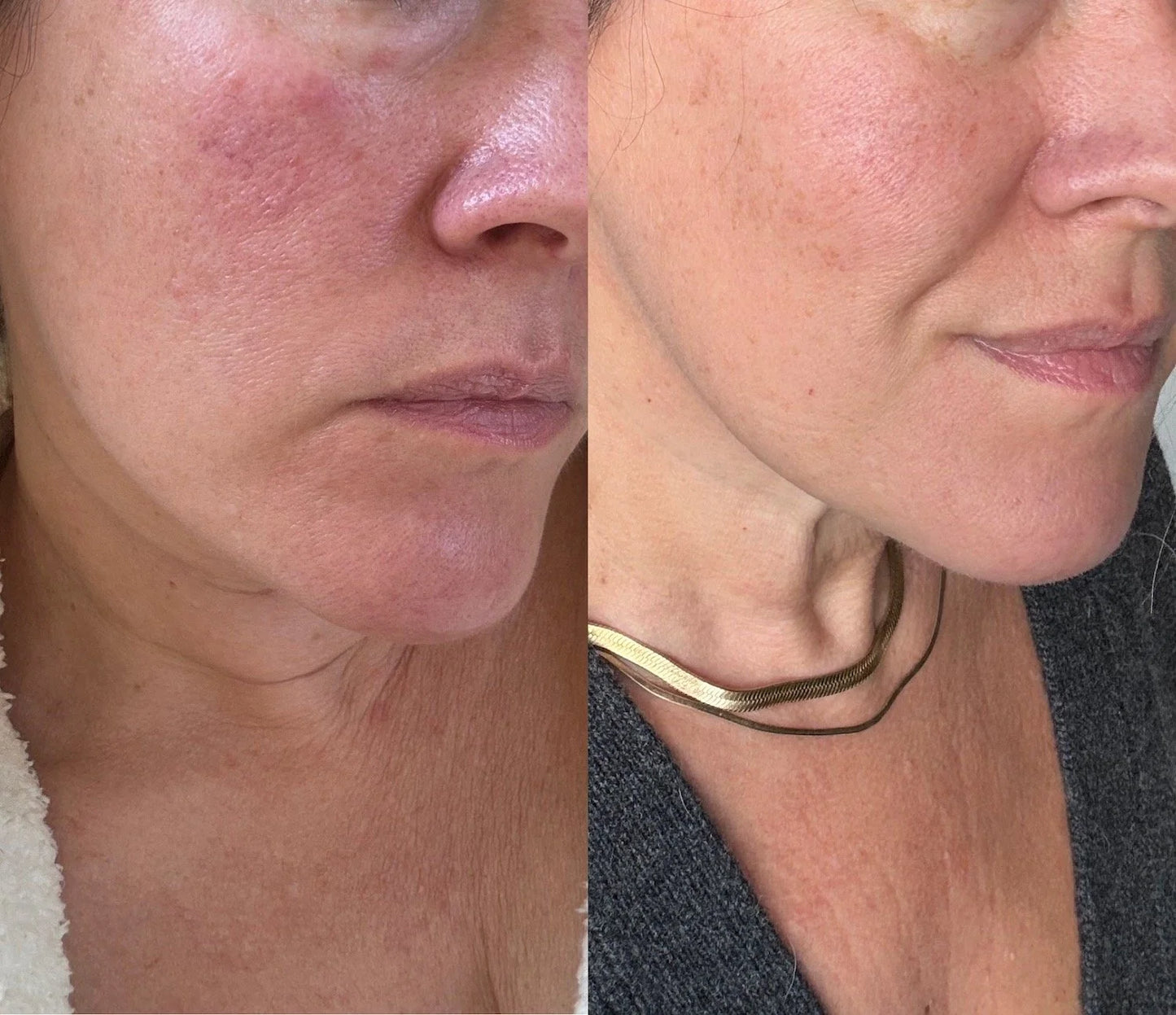 6 Peptide Essence Facial Refreshing Skin Care