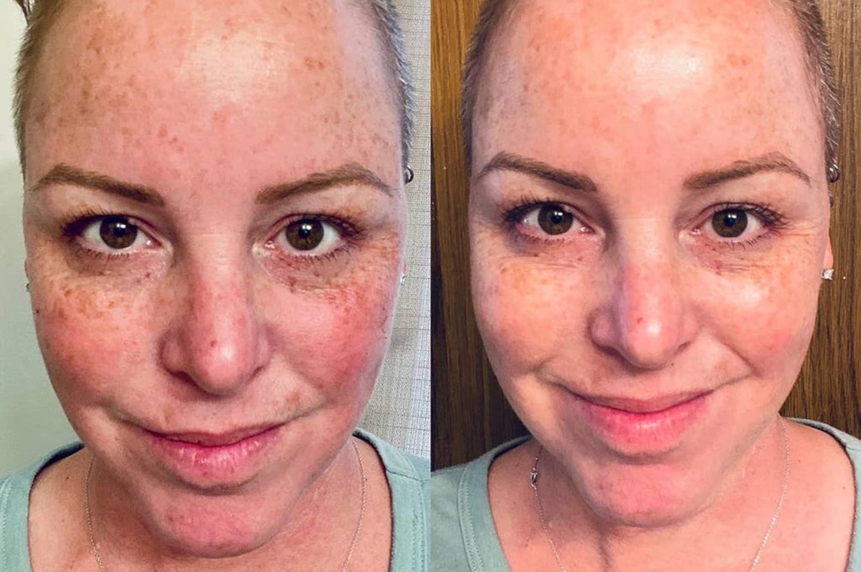 6 Peptide Essence Facial Refreshing Skin Care