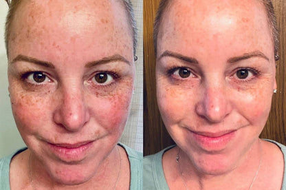 6 Peptide Essence Facial Refreshing Skin Care